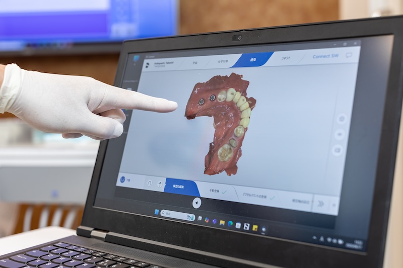 不安を解消するためにお口の見える化をしています