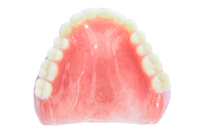 レジン床義歯（保険診療）